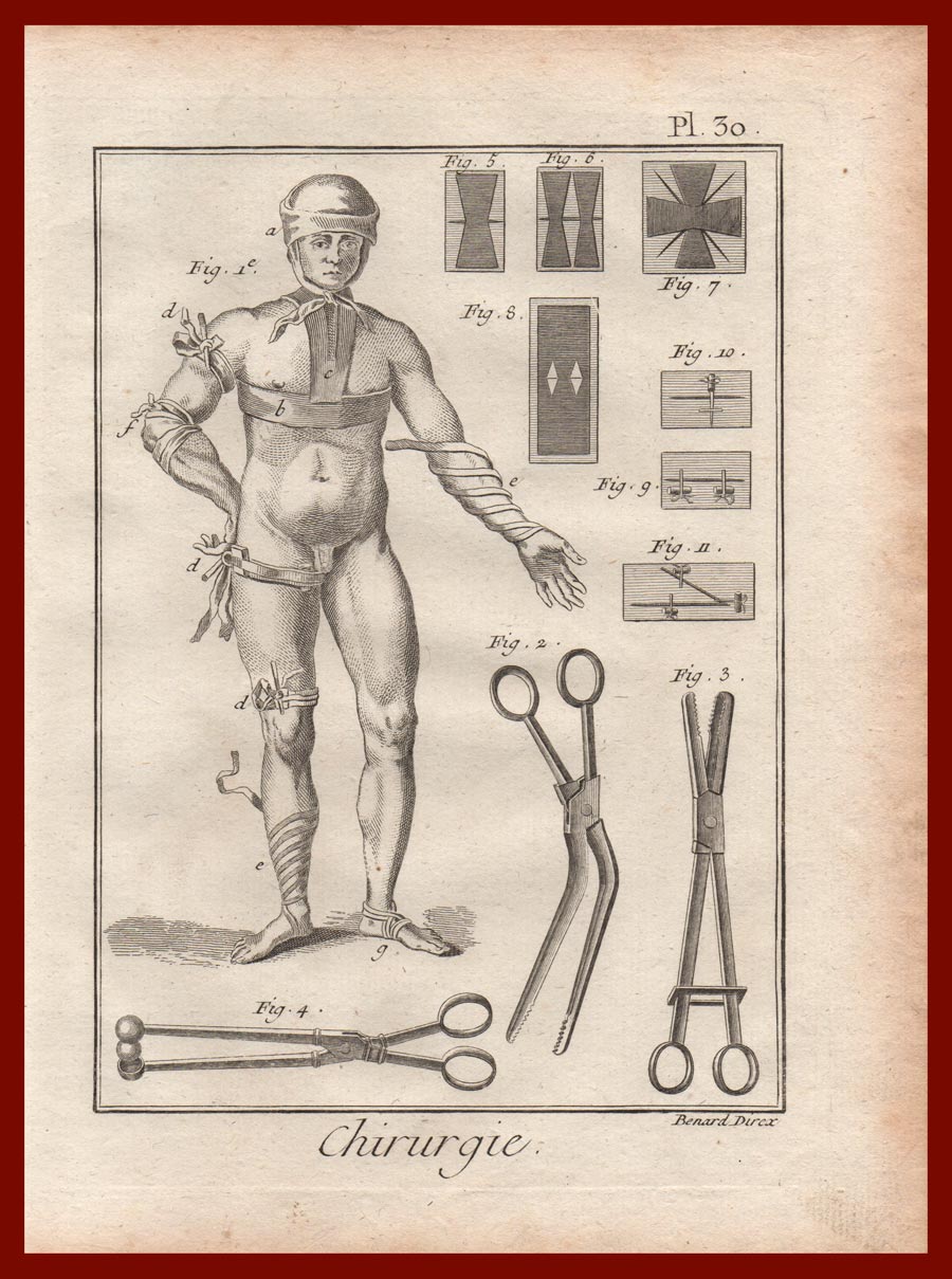 stampa antica bendaggi