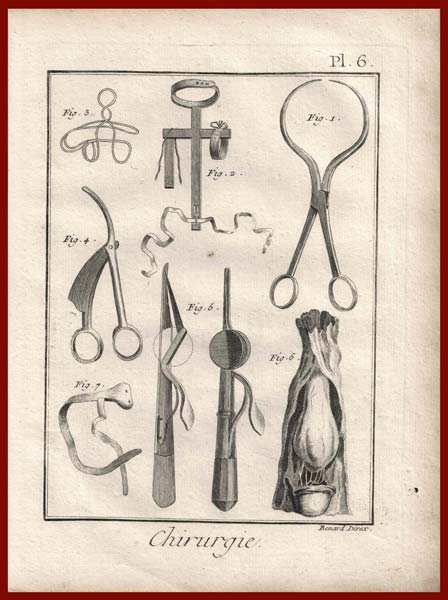 stampa antica chirurgia diderot